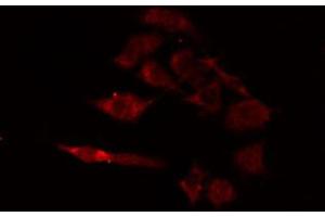 Image no. 2 for anti-Cytochrome B5 Type A (Microsomal) (CYB5A) (Internal Region) antibody (ABIN6259625)