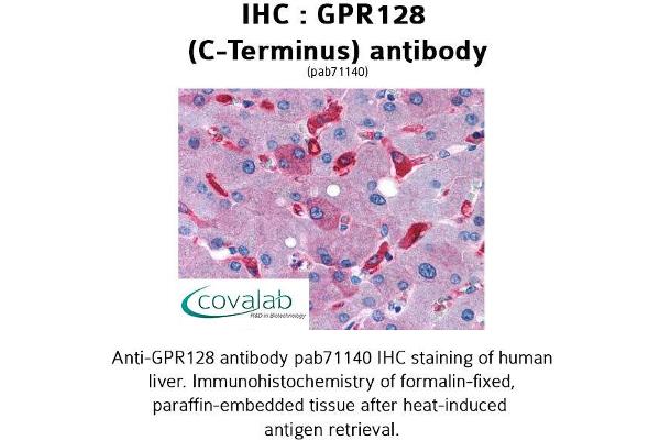 G Protein-Coupled Receptor 128 antibody  (C-Term)