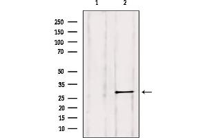 Image no. 2 for anti-RAB11B, Member RAS Oncogene Family (RAB11B) antibody (ABIN6264548)