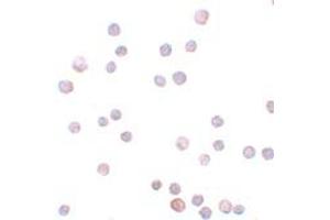 Immunohistochemistry (IHC) image for anti-Zinc Finger E-Box Binding Homeobox 1 (ZEB1) (Middle Region) antibody (ABIN1031173)