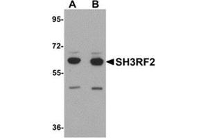 Image no. 1 for anti-SH3 Domain Containing Ring Finger 2 (SH3RF2) (C-Term) antibody (ABIN783691)