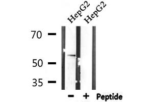 Image no. 2 for anti-serine/threonine Kinase 38 Like (STK38L) (C-Term) antibody (ABIN6265344)