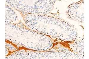 Image no. 2 for anti-Janus Kinase 1 (JAK1) (pTyr1034), (pTyr1035) antibody (ABIN6255762)