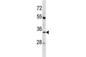 Image no. 1 for anti-Aquaporin 3 (Gill Blood Group) (AQP3) (AA 163-191) antibody (ABIN3030004)