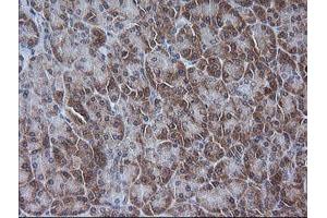 Image no. 7 for anti-V-Ets Erythroblastosis Virus E26 Oncogene Homolog 2 (ETS2) (AA 90-349) antibody (ABIN1491702)