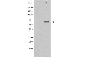 Image no. 1 for anti-Tectonic Family Member 3 (TCTN3) (Internal Region) antibody (ABIN6265509)
