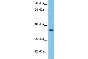 Image no. 9 for anti-Asialoglycoprotein Receptor 1 (ASGR1) (N-Term) antibody (ABIN2778132)