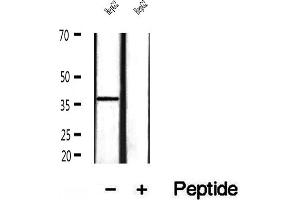 Image no. 1 for anti-Methionine Adenosyltransferase II, beta (MAT2B) (Internal Region) antibody (ABIN6263142)