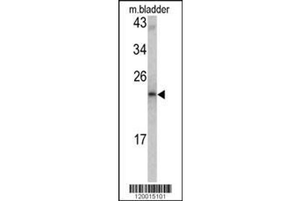 anti-Malignant T Cell Amplified Sequence 1 (MCTS1) (AA 1-30), (N-Term) antibody