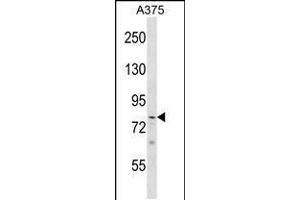 Image no. 1 for anti-PHD Finger Protein 21A (PHF21A) (AA 436-464) antibody (ABIN5531840)
