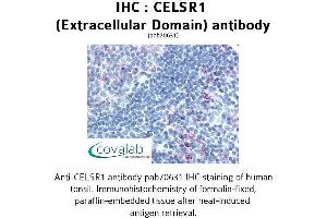 Image no. 1 for anti-Cadherin EGF LAG Seven Pass G-Type Receptor 1 (CELSR1) (1st Extracellular Domain) antibody (ABIN1732964)