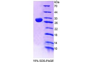 Image no. 1 for 2',3'-Cyclic Nucleotide 3' phosphodiesterase (CNP) (AA 186-421) protein (His tag) (ABIN6239070)