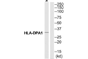 Image no. 1 for anti-Major Histocompatibility Complex, Class II, DP alpha 1 (HLA-DPA1) (N-Term) antibody (ABIN1577026)