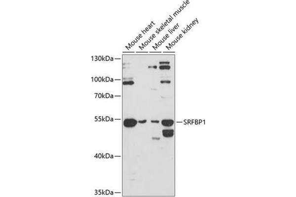 SRFBP1 抗体  (AA 1-300)
