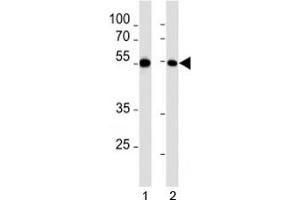 MEF2C Antikörper  (AA 365-394)