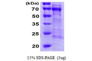 Image no. 1 for Cell Division Cycle 25 Homolog A (S. Pombe) (CDC25A) (AA 1-524) protein (His tag) (ABIN6386706)