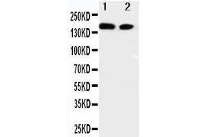 Image no. 1 for anti-V-Erb-A erythroblastic Leukemia Viral Oncogene Homolog 4 (Avian) (ERBB4) (AA 35-51), (N-Term) antibody (ABIN3044100)