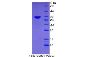 Image no. 1 for CD109 (CD109) protein (ABIN3008799)