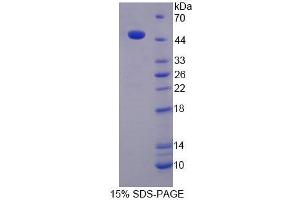 Image no. 1 for Kininogen 1 (KNG1) (AA 19-380) protein (His tag) (ABIN6236733)