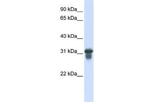 Image no. 2 for anti-Solute Carrier Family 25 (Mitochondrial Carrier, Oxoglutarate Carrier), Member 11 (SLC25A11) (C-Term) antibody (ABIN2781592)
