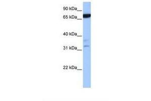 Image no. 1 for anti-Zinc Finger Protein 340 (ZNF340) (N-Term) antibody (ABIN6739296)