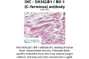 Image no. 2 for anti-SH3-Domain GRB2-Like Endophilin B1 (SH3GLB1) antibody (ABIN1739236)