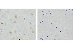 Image no. 3 for anti-Enolase 2 (Gamma, Neuronal) (ENO2) (N-Term) antibody (ABIN1574103)