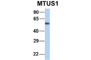 Image no. 9 for anti-Microtubule Associated Tumor Suppressor 1 (MTUS1) (Middle Region) antibody (ABIN2781855)
