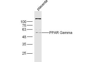 Image no. 3 for anti-Peroxisome Proliferator-Activated Receptor gamma (PPARG) (AA 315-420) antibody (ABIN1386283)