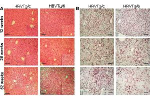 Image no. 2 for anti-Hepatitis B Virus Surface Antigen (HBsAg) antibody (ABIN285516)