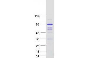 Image no. 1 for rho GTPase Activating Protein 9 (ARHGAP9) (Transcript Variant 3) protein (Myc-DYKDDDDK Tag) (ABIN2714885)
