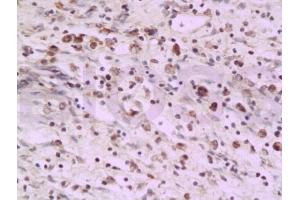Image no. 2 for anti-PCNA Clamp Associated Factor (PAF) antibody (ABIN737931)