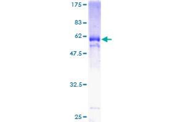 KLF6 Protein (AA 1-260) (GST tag)