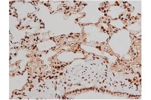 Image no. 6 for anti-Mast/stem Cell Growth Factor Receptor (KIT) (pTyr721) antibody (ABIN6256004)