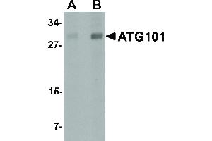 Image no. 1 for anti-Chromosome 12 Open Reading Frame 44 (C12orf44) (Internal Region) antibody (ABIN6656979)