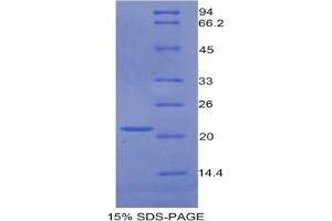 Image no. 2 for Growth Arrest-Specific 6 (GAS6) ELISA Kit (ABIN6730934)