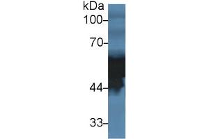 Image no. 3 for alpha-2-HS-Glycoprotein (AHSG) ELISA Kit (ABIN6730899)