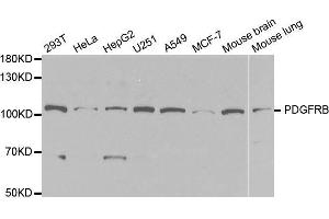 PDGFRB antibody  (AA 887-1106)