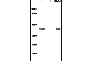 Image no. 1 for anti-Adrenergic, beta-2-, Receptor, Surface (ADRB2) (AA 201-300) antibody (ABIN730153)
