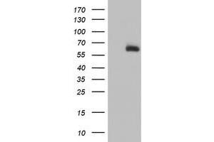 Image no. 2 for anti-Acyl-CoA Synthetase Medium-Chain Family Member 5 (ACSM5) antibody (ABIN2715691)