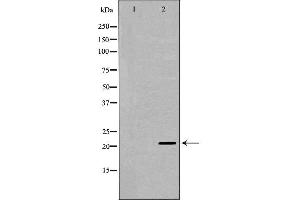 Image no. 1 for anti-RAP1A, Member of RAS Oncogene Family (RAP1A) (C-Term) antibody (ABIN6264636)