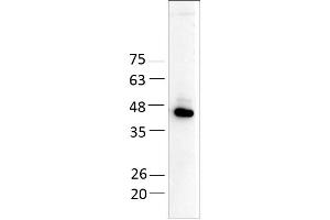 Western Blotting (WB) image for Aminoadipate Aminotransferase (AADAT) (AA 30-425) protein (His tag) (ABIN3120175)