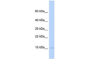 Image no. 1 for anti-Small Ubiquitin Related Modifier 3 (SUMO3) (Middle Region) antibody (ABIN2787608)