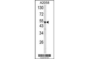 Image no. 2 for anti-Annexin A7 (ANXA7) (Center) antibody (ABIN2157737)