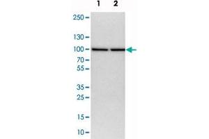 Image no. 2 for anti-Nucleoporin 93kDa (NUP93) antibody (ABIN5584863)