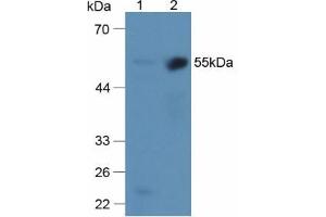 Image no. 2 for anti-Alpha2 Antiplasmin (SERPINF2) (AA 340-491) antibody (ABIN1172474)