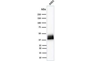 Image no. 1 for anti-Tumor-Associated Calcium Signal Transducer 2 (TACSTD2) (AA 31-274) antibody (ABIN6939971)