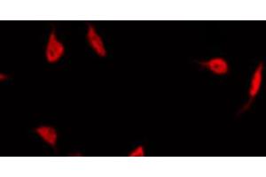 Image no. 3 for anti-Peroxisome Proliferator-Activated Receptor gamma (PPARG) (pSer112) antibody (ABIN6256109)