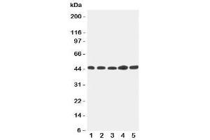 Image no. 2 for anti-Hepsin (HPN) (C-Term) antibody (ABIN3031191)