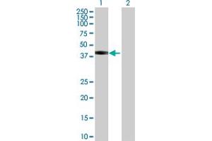 Image no. 1 for anti-Spastic Paraplegia 11 (Autosomal Recessive) (SPG11) (AA 1-425) antibody (ABIN529220)